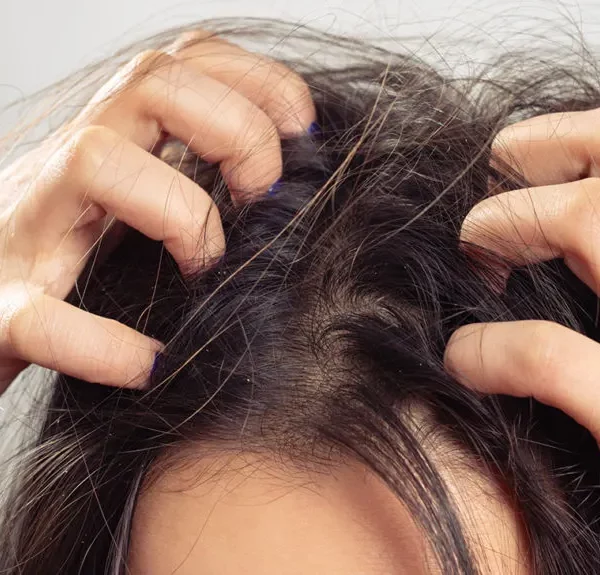 Best Ways to Remove Scalp Buildup According to Dermatologists