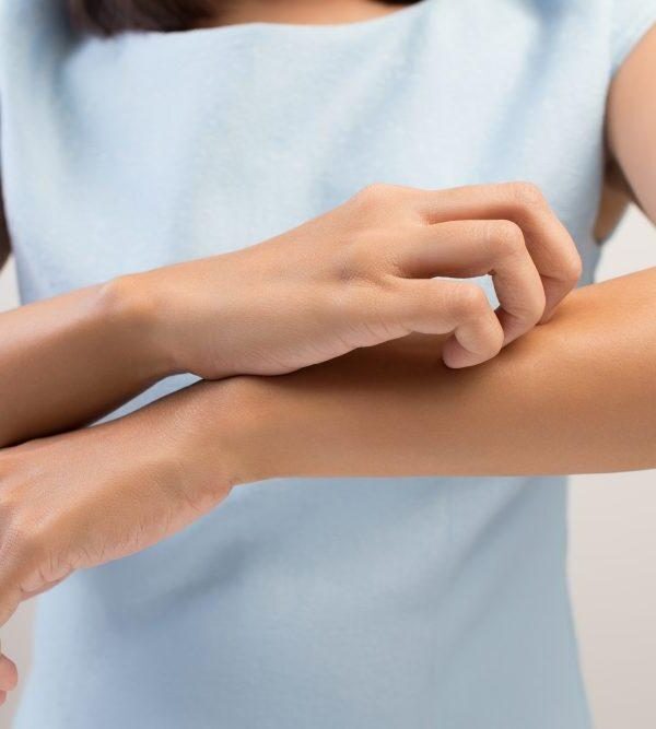 Dealing with Itchy Skin: Causes, Relief, and Your Burning Questions