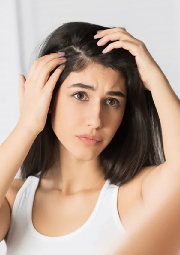 Dealing with Dandruff: Understanding the Different Types and Effective Solutions