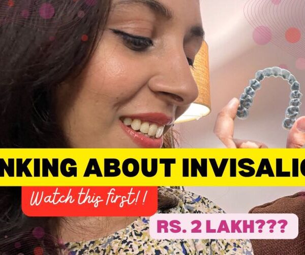 Starting Invisalign: What to Expect (My Honest Experience So Far)