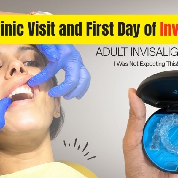 My Invisalign Journey Week-by-Week: Day 15 Update (Tray 1 to Tray 2) — The Pain, The Progress, and What No One Warned Me About