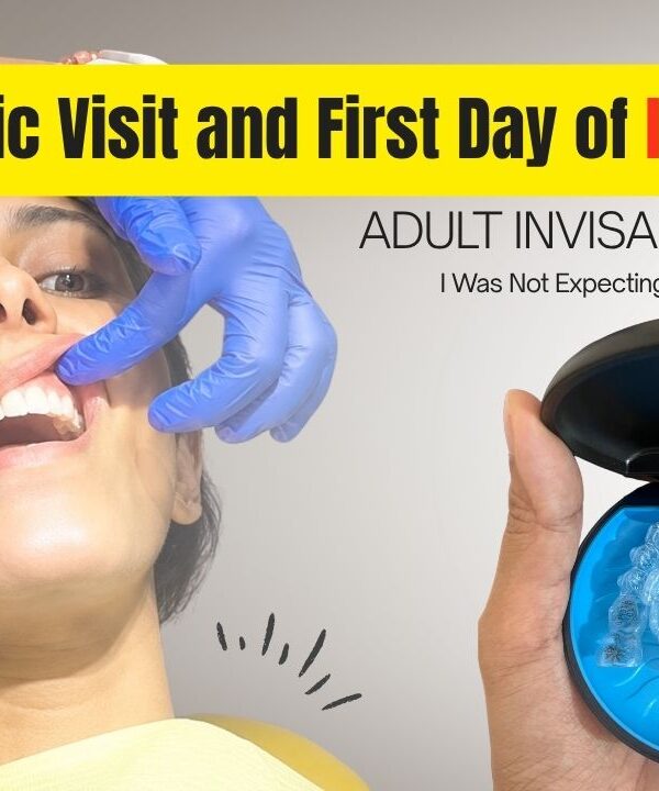 My Invisalign Journey Week-by-Week: Day 15 Update (Tray 1 to Tray 2) — The Pain, The Progress, and What No One Warned Me About